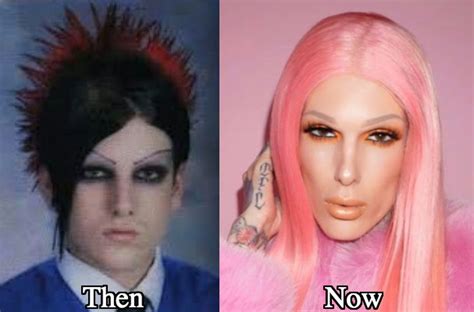 Jeffree Star Plastic Surgery Before And After Photos