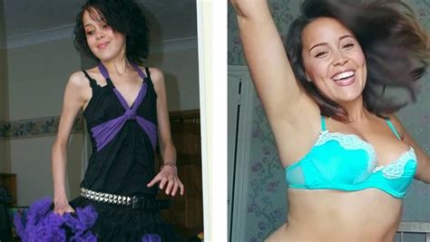 Former Anorexia Sufferer Shares Comparison Photos To Promote Body