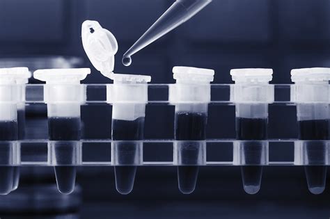 pcr test rate japan is as low as south america, equivalent to cambodia the number of corona tests in the the drive through pcr testing facility available at muscat international airport (mia) which. What Is the Value of PCR Testing in COVID-19 Diagnosis ...