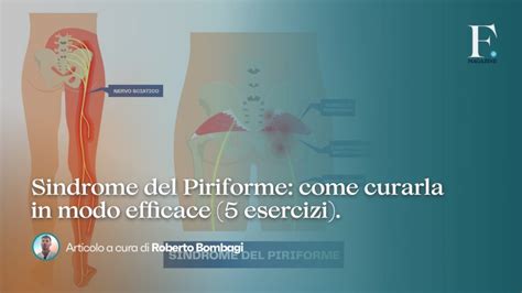 Sindrome Del Piriforme Come Curarla In Modo Efficace Fisio Magazine