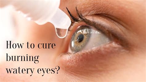 How To Cure Burning Watery Eyes Successyeti