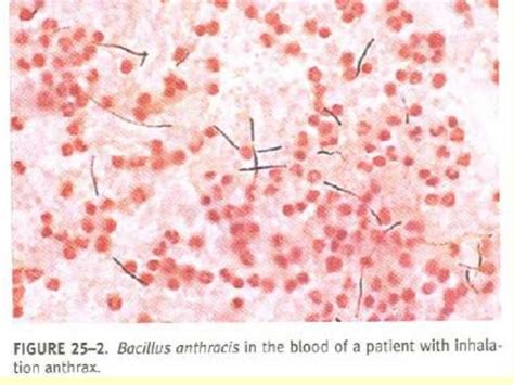 1 Spore Forming Gram Positive Bacilli 2014