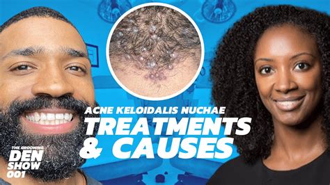 Acne Keloidalis Nuchae Symptoms Causes Treatments Dermatologist Dr