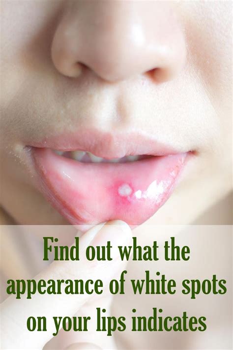 Small Bumps On Your Lips And Inside Your Mouth Are Actually Quite