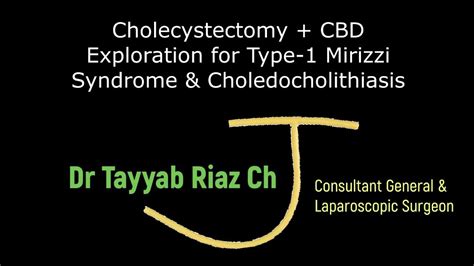 Choledocholithiasis Mirizzi Syndrome CBD Exploration And