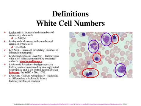 Ppt Morphologic And Distributive Leukocyte Disorders Powerpoint
