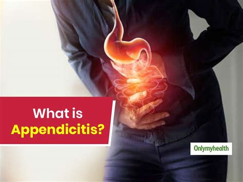 What Is Appendicitis Facts About Appendicitis Infogra