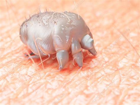 illustration of a scabies mite on human skin stock image f023 7765 science photo library