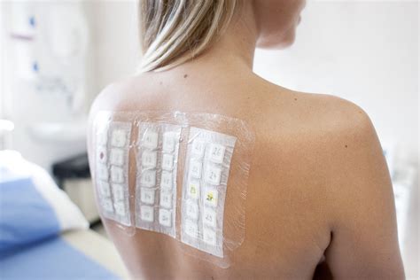 The 7 Best At Home Allergy Tests Of 2022