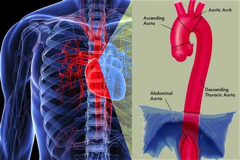 Thoracic Aortic Aneurysm Arterial Circulatory System Image Images And