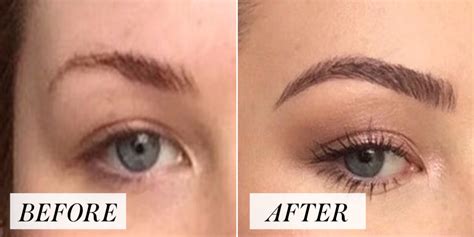 Womans Overplucked Brow Transformation Goes Viral Before And After