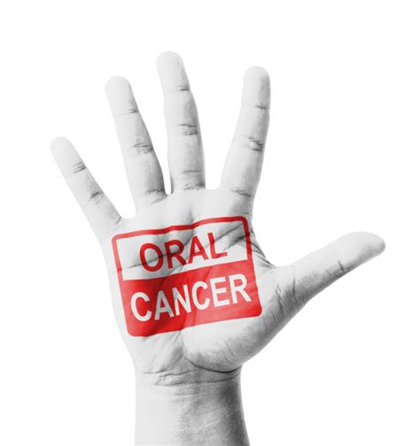 Everything You Need To Know About Oral Cancer Metro Herald