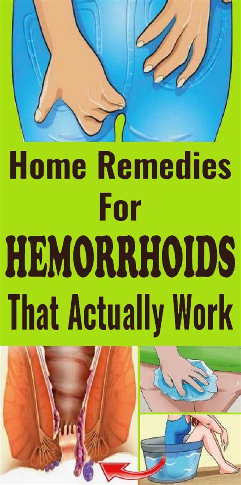 Home Remedies For Hemorrhoids That Actually Work Home Remedies For