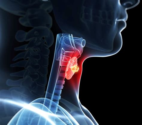 Thyroid Pictures