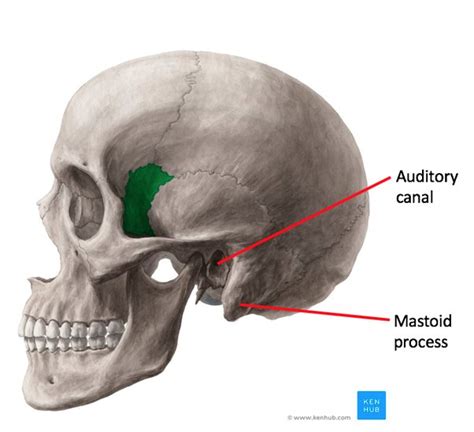 Cranial Dents