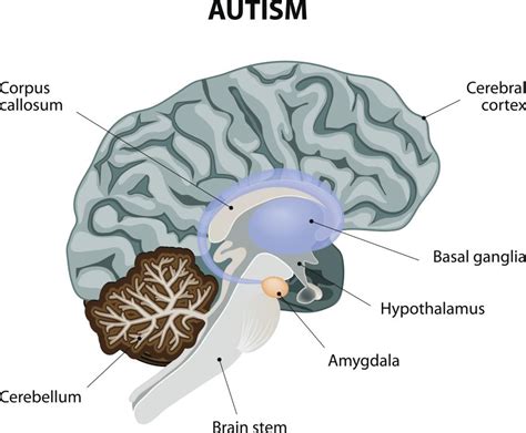 Amygdala Neurons Reduced In Adults With Autism Neurology Advisor