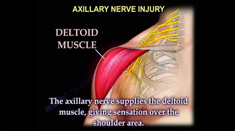 Nerve Injury Injuries Complete Everything You Need To Know Dr