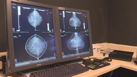 Improved Breast Cancer Detection Also Means More Benign Biopsies
