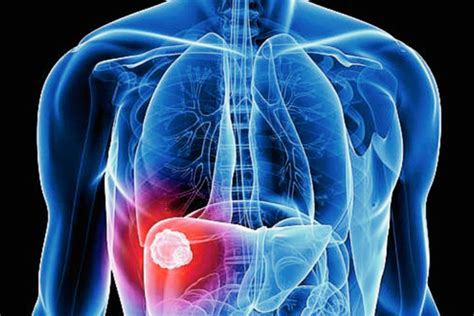 Simple Science: How to Make a Volcano with Kids