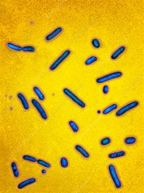 Pseudomonas Aeruginosa Bacteria Lm Stock Image C0282791 Science