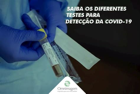 Saiba os diferentes testes para detecção da Covid 19 Omnimagem