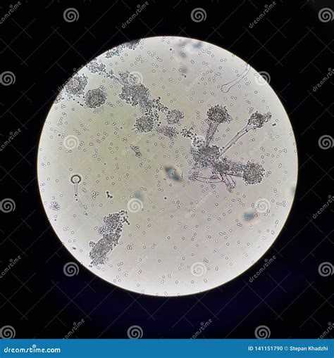 Fungi Under Microscopic View Aspergillus Fungus Microbiology Stock