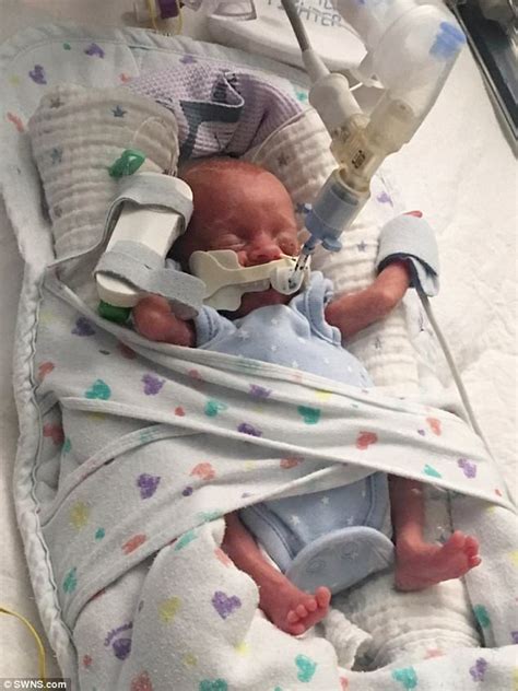Meet The Miracle Baby Boy Born At 22 Weeks Daily Mail Online