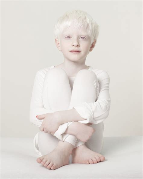 Albino Nude Pics Hot Teen Celebrity