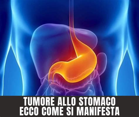 Tumore Allo Stomaco Fattori Di Rischio Sintomi Diagnosi E Cura Bazzing