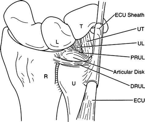 Ulnar Sided Wrist Pain In The Athlete Sport Specific Demand