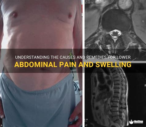 Understanding The Causes And Remedies For Lower Abdominal Pain And