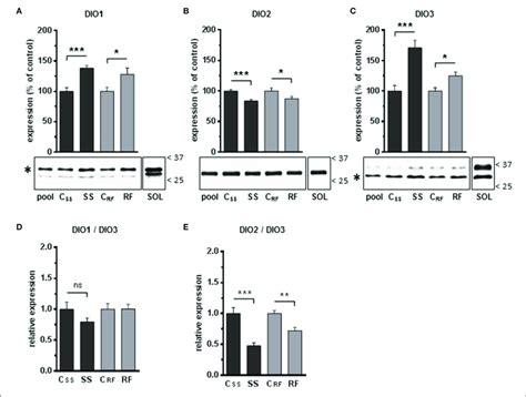Expression Levels Of The Iodothyronine Deiodinases DIO1 DIO2 And