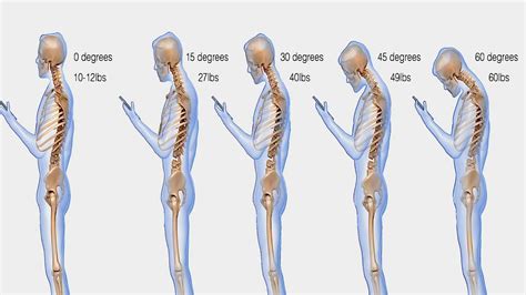 Heres Exactly Why The Weight Of Your Head Is Causing Problems