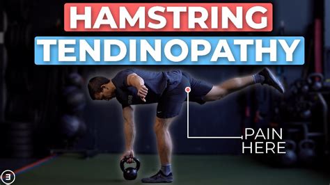 Proximal Hamstring Tendinopathy Rehab 4 Stages Youtube