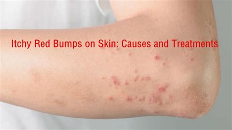 Itchy Red Bumps On Skin Common Causes With Treatment