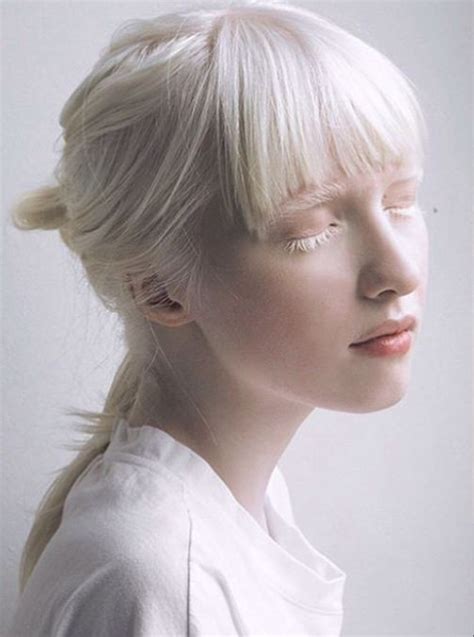 Pin By Alison Barnes Martin Photograp On Faces Albino Model Albinism Portrait Inspiration