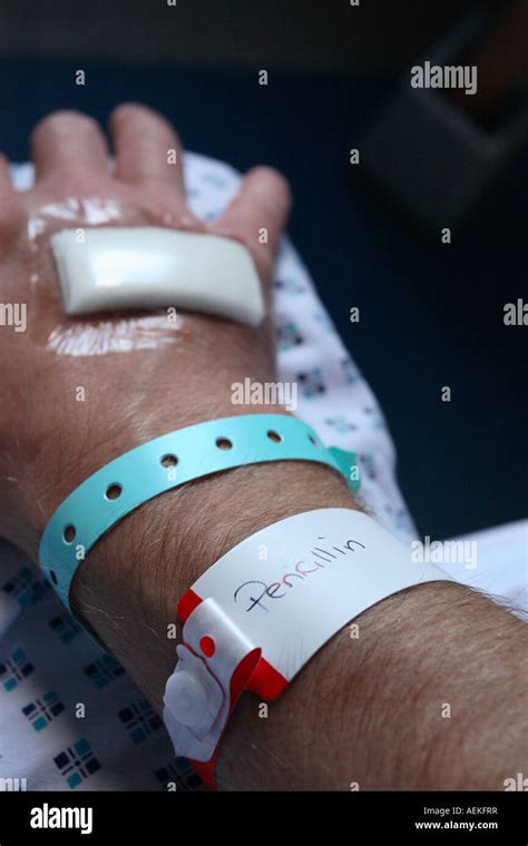 Hospital Patient With Wristband Identifying An Allergy To Penicillin