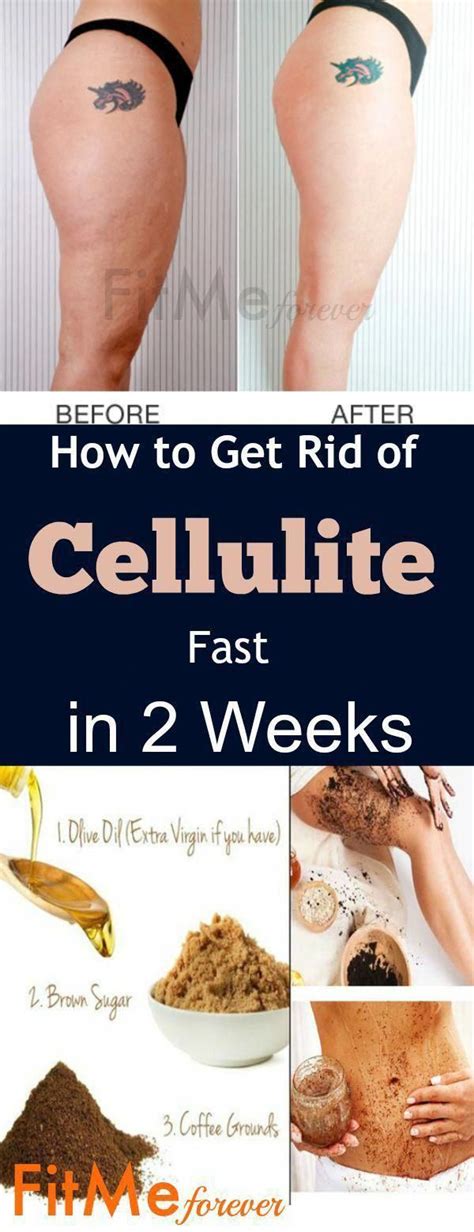 Pin On Best Way To Get Rid Of Cellulite