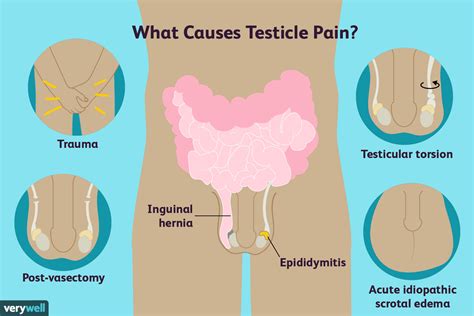 Testicular Pain Causes Diagnosis And Treatment