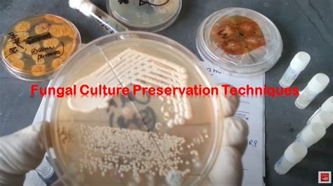 Fungal Culture Preservation Introduction Techniues And Detals About Ste