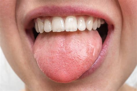 Human Tongue Stock Photos Pictures And Royalty Free Images Istock