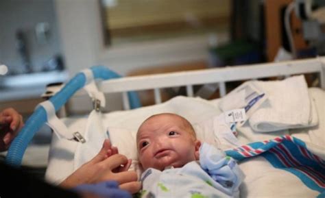 ‘miracle Baby Born Without A Nose Is One Of Just 37 In The World