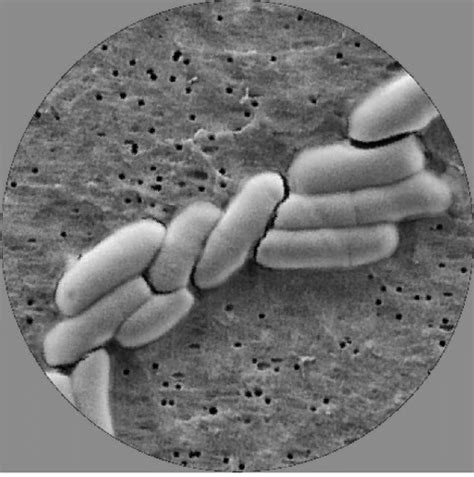 Bifidobacterium Animalis Subsp Lactis Bb 12 Chr Hansen Strain