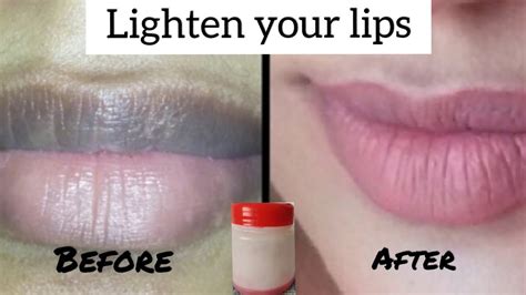 Lip Lightening Serum No More Dark Lips How To Remove Pigmentation