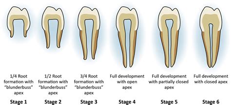 Regenerative Endodontic Procedures Dental Clinics