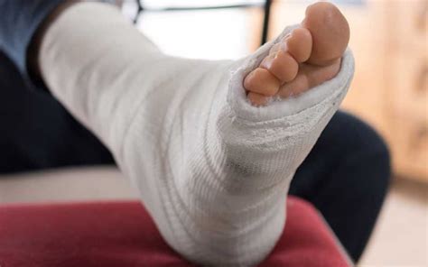 Leg Knee And Ankle Fracture Compensation Claims Mccarthy Co