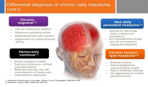 Chronic Daily Headache The Shapero Markham Headache And Pain