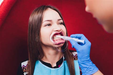 Dentist Curing Female Patient Woman Teeth Examined At Dentists Teeth