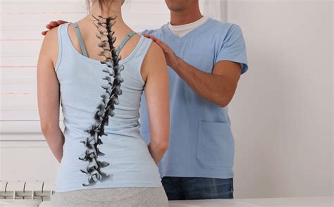 Reasons To Visit A Chiropractor If You Have Scoliosis Kouimanis Chiropractic Crown Point