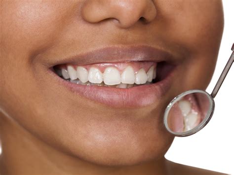 Gingival Overgrowth Gums Growing Over Teeth Ask Dr Weil